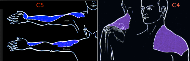 Dermatome C4 et C5