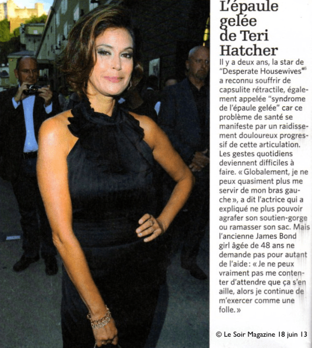 Capsulite rétractile pauvre James Bond girl