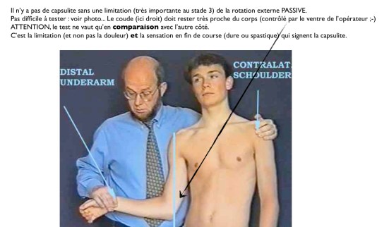 Test majeur capsulite épaule