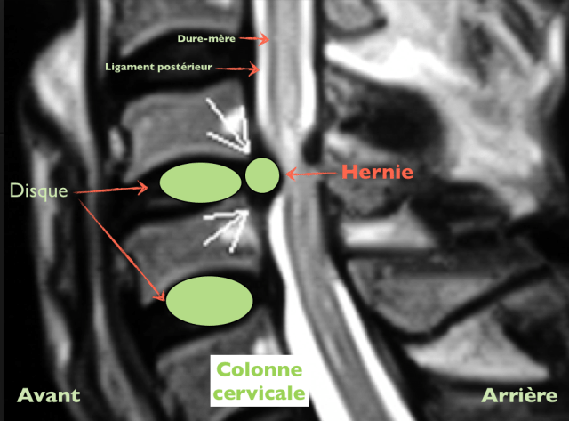 Capture d’écran 2013-10-04 à 17.45.34