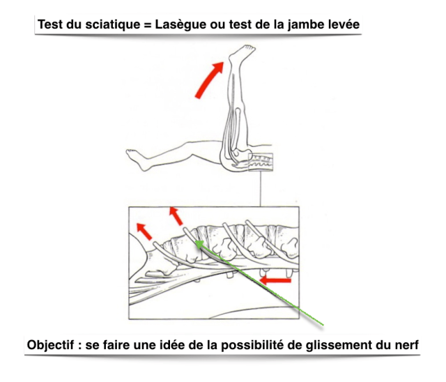 Lassague Lombalgies-sciatique « ORTHOPEDIE POUR TOUS