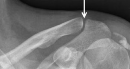 Capture d’écran 2018-02-05 à 03.05.16.png